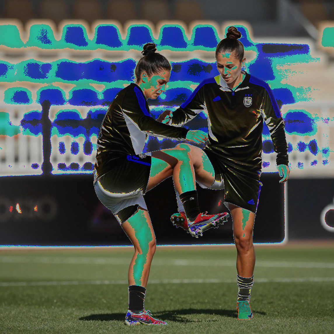 Trossard's Calcaneal Bone Edema: What Beşiktaş Lost and What They Have Not Said